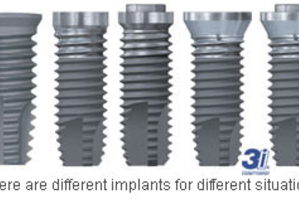 3i-different-implants.jpg 